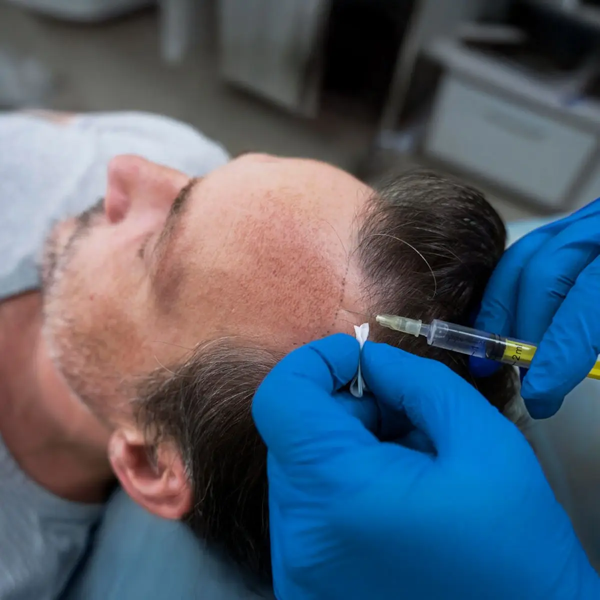 Restoring Confidence in the Heart of London: Why Men Are Quietly Choosing Harley Street for Hair Transplants