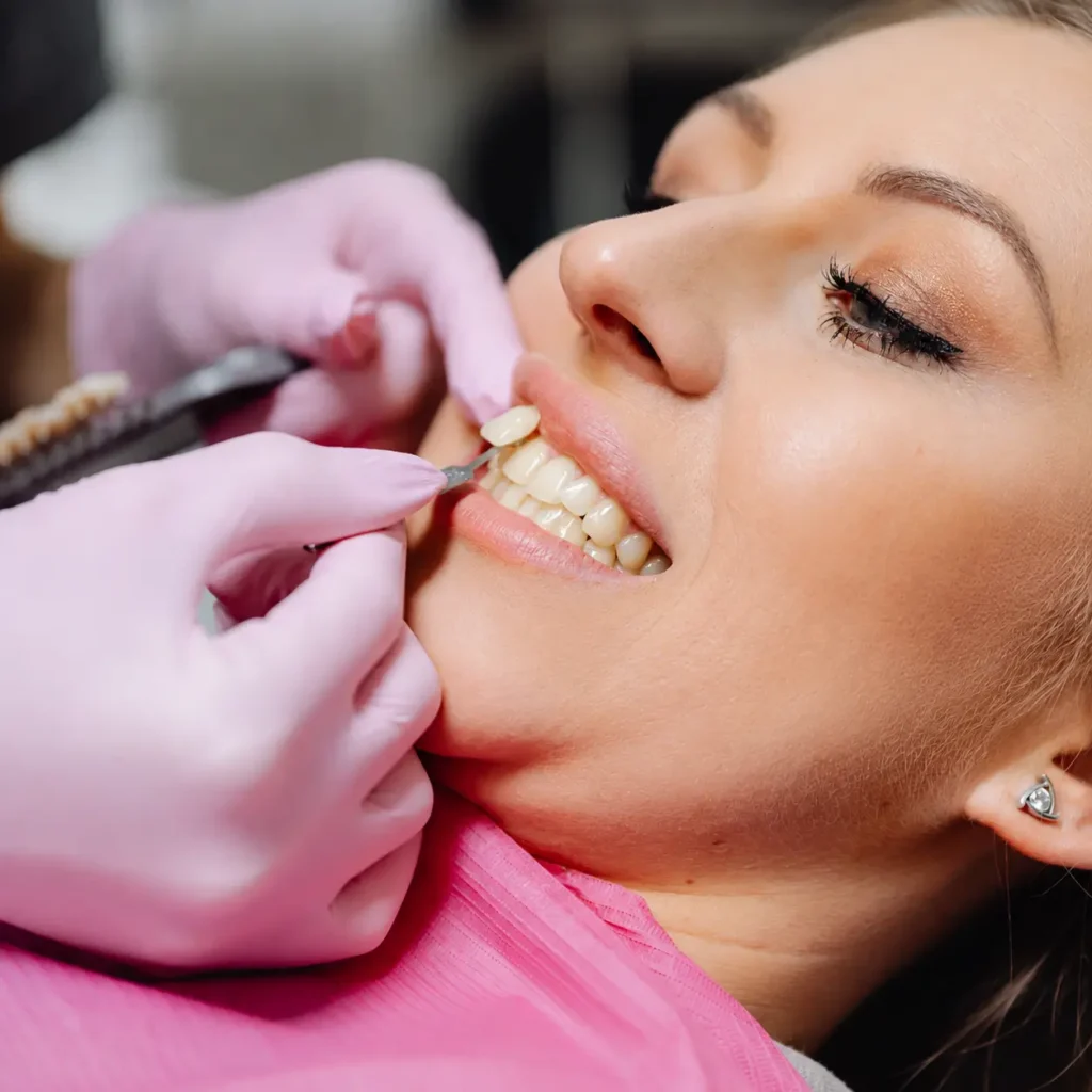 Porcelain Veneers